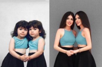 Gulcan dan Sahinur. (Instagram/@thegstwins)