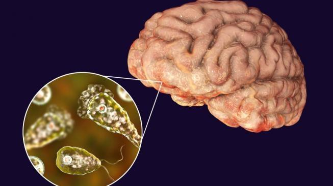 Ilustrasi ameba di otak. (Shutterstock)