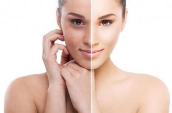 Ingin Punya Kulit Tanning? Coba Pakai Teh Hitam Yuk!