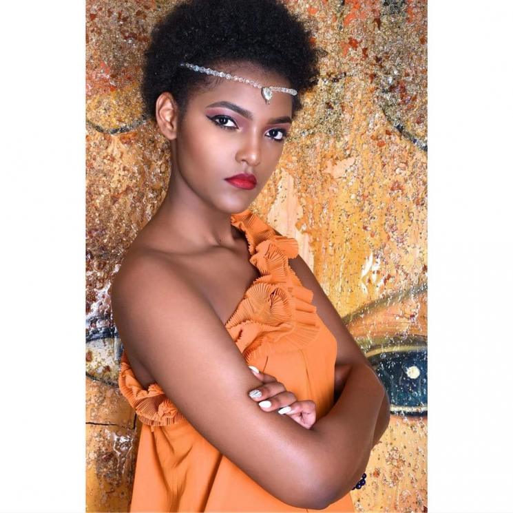 Dorcas Kasinde, Miss Africa yang rambutnya terbakar. (Instagram/@dorcas_dienda)