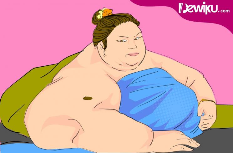 Ilustrasi wanita tergemuk di Kalimantan Tengah benama Titi Wati yang mempunya bobot 350 kg lebih. (Arkadia Digital Media/Ema Rohimah)