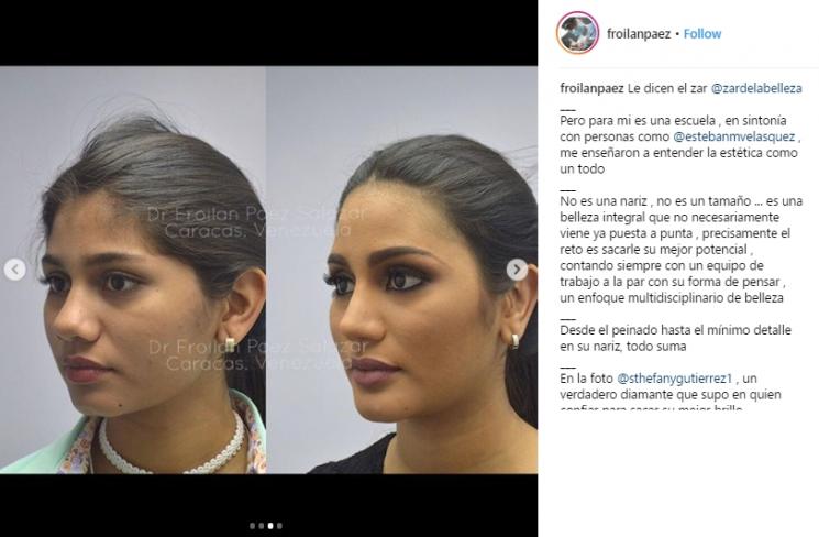 Sthefany Gutierrez, Juara 3 Miss Universe 2018 Ini Jadi Kontroversi. (Instagram/@froilanpaez)