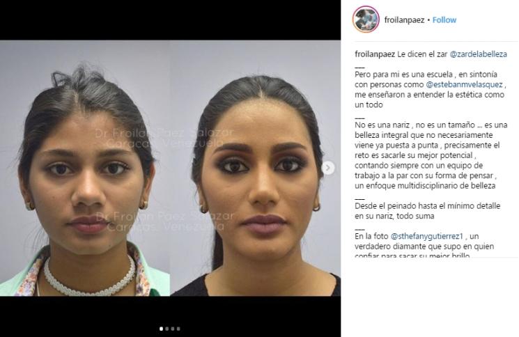 Sthefany Gutierrez, Juara 3 Miss Universe 2018 Ini Jadi Kontroversi. (Instagram/@froilanpaez)