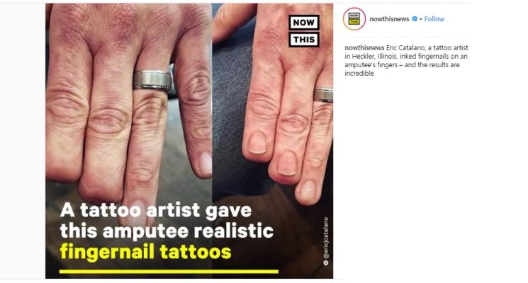 Seniman tato ini beri dukungan kepada penyitas tubuh cacat. (Instagram/@nowthisnews)