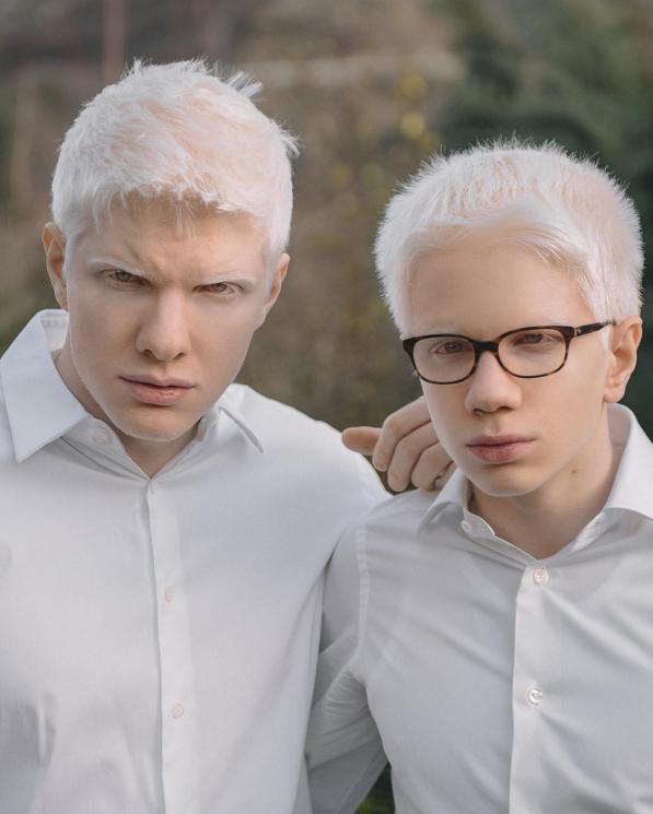 Bera Ivanishvili, cowok albino paling ganteng sejagat raya. (Instagram/@beraofficial)