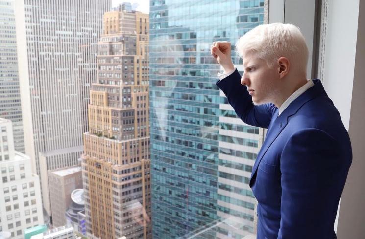 Bera Ivanishvili, cowok albino paling ganteng sejagat raya. (Instagram/@beraofficial)