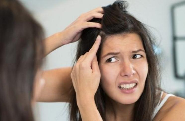 Mengeluhkan rambut beruban. (Shutterstock)