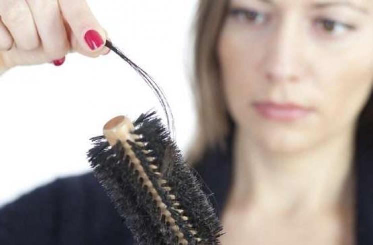 Masalah rambut rontok. (Shutterstock)