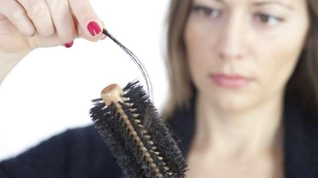 Masalah rambut rontok. (Shutterstock)