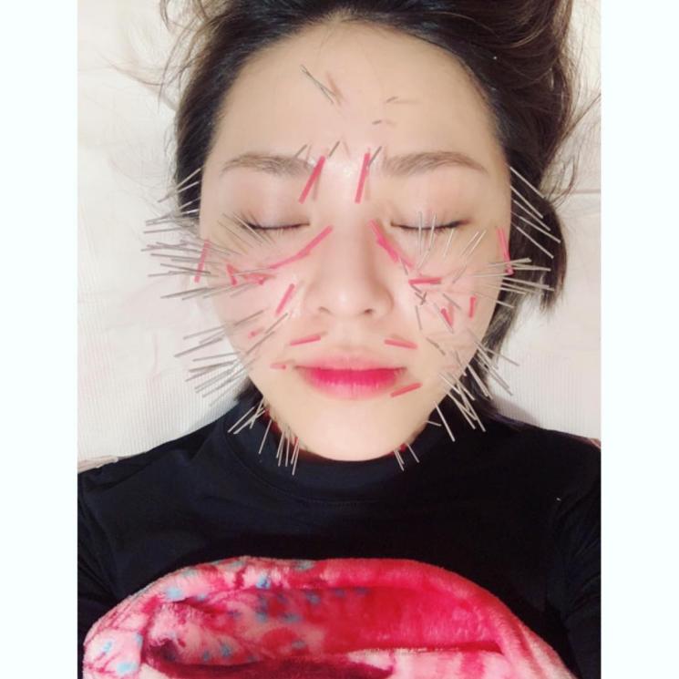 Ratusan jarum di wajah Belle Zhuo. (Instagram/@beargenie)