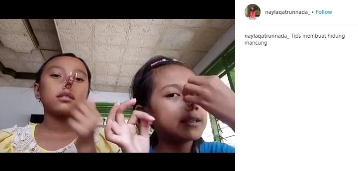 Bocah Ini Bikin Tips Membuat Hidung Mancung. (Instagram/@naylaqatrunnada_)