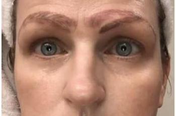 Gagal Cantik, Wanita Ini Punya 4 Alis Setelah Jalani Microblading