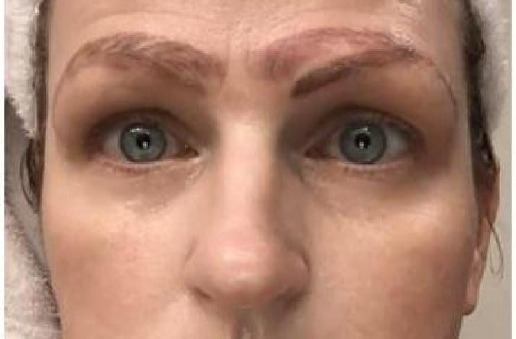 Gagal Cantik, Wanita Ini Punya 4 Alis Setelah Jalani Microblading