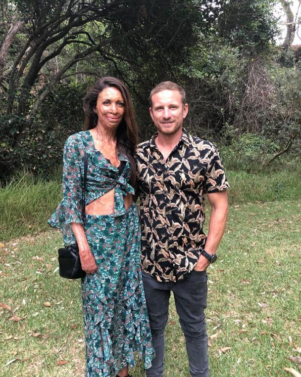 Michael Hoskin dan istrinya, Turia Pitt. (Instagram/@turiapitt)