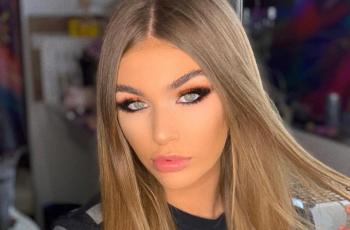 Masa Lalu Bikin Malu, Tukang Bully Terpilih Jadi Miss Universe Albania