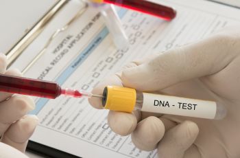 Kaget Lihat Hasil Tes DNA, Wanita Ini Tak Menyangka Punya 36 Saudara Seayah