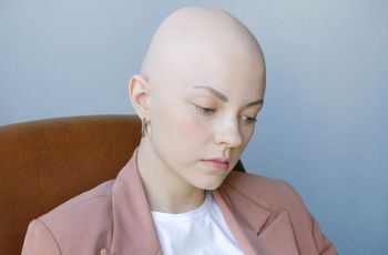 Akibat Jalani Tes Ini, Curhat Wanita Alami Kerontokan Rambut hingga 80 Persen