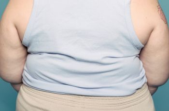 Sudah Obesitas, Wanita Ini Masih Ngotot Naikkan Berat demi Pinggul Terbesar