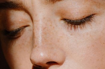Iseng Ikuti Tutorial Bikin Freckles Palsu, Wanita Ini Malah Berujung Jadi Manusia Emas