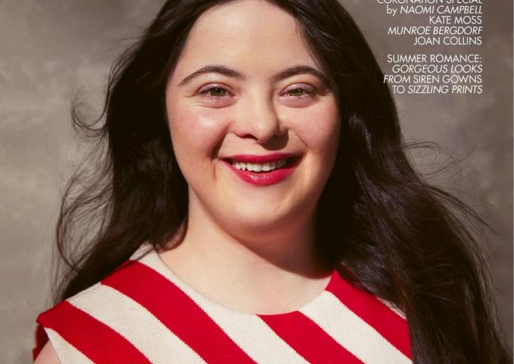 Potret Ellie Goldstein saat menjadi model pada sampul majalah British Vogue (Instagram/@ elliejg16_zebedeemodel)
